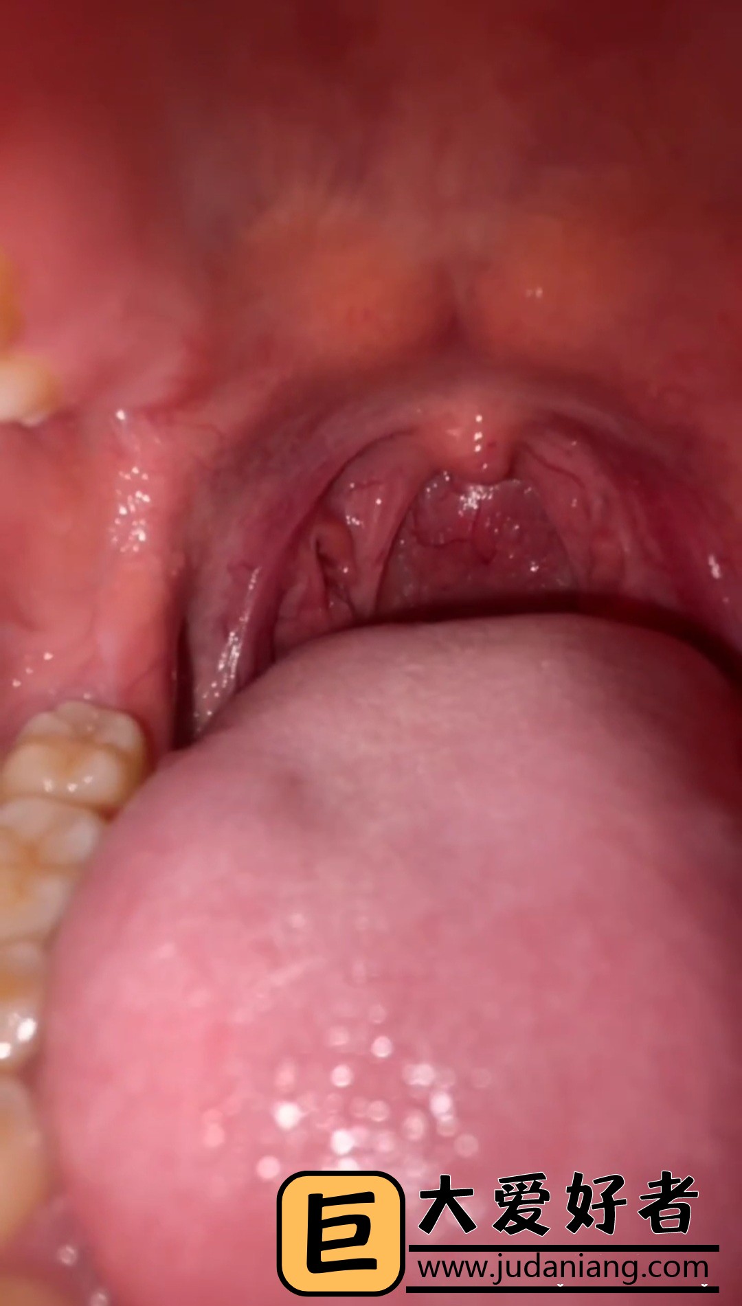 ��������С�������ʳ