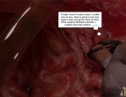 ���Էѽ�ת����LittleWindmill��The Vertred Files: The doctor is IN